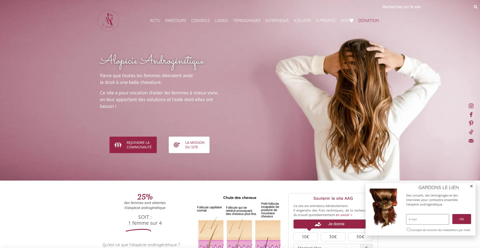 Alopecieandrogenetique.com