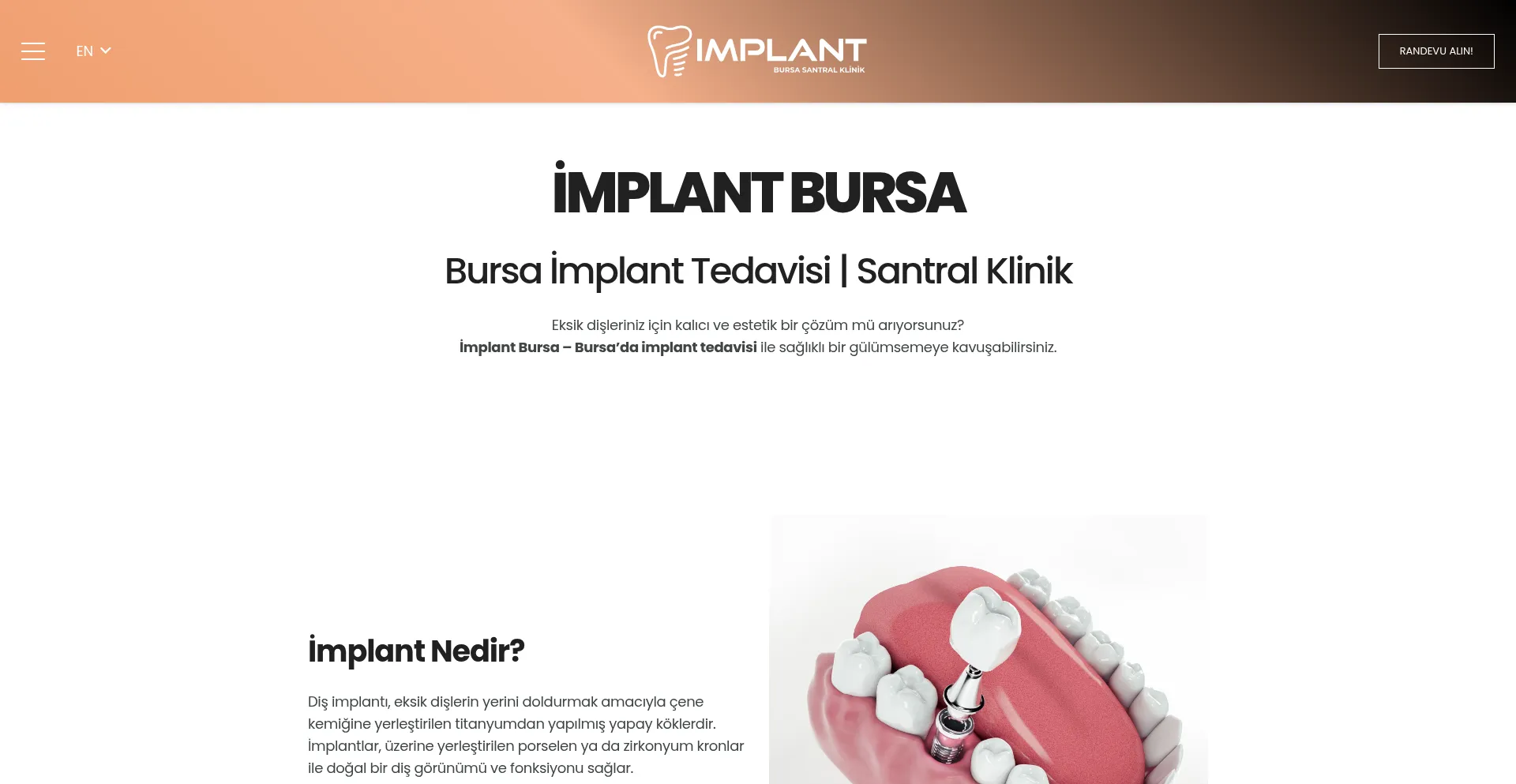 Implantbursa.com